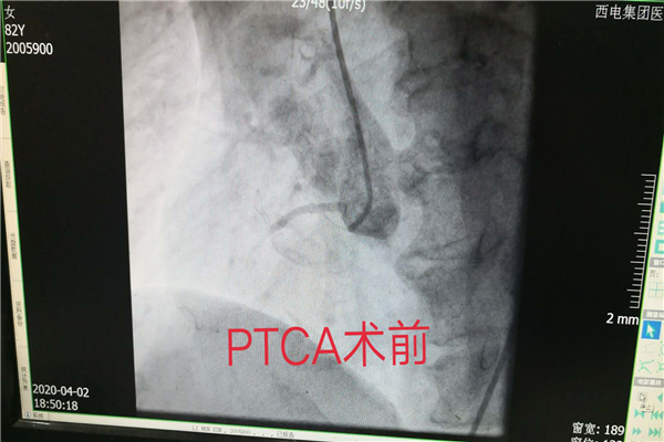 图片2.png