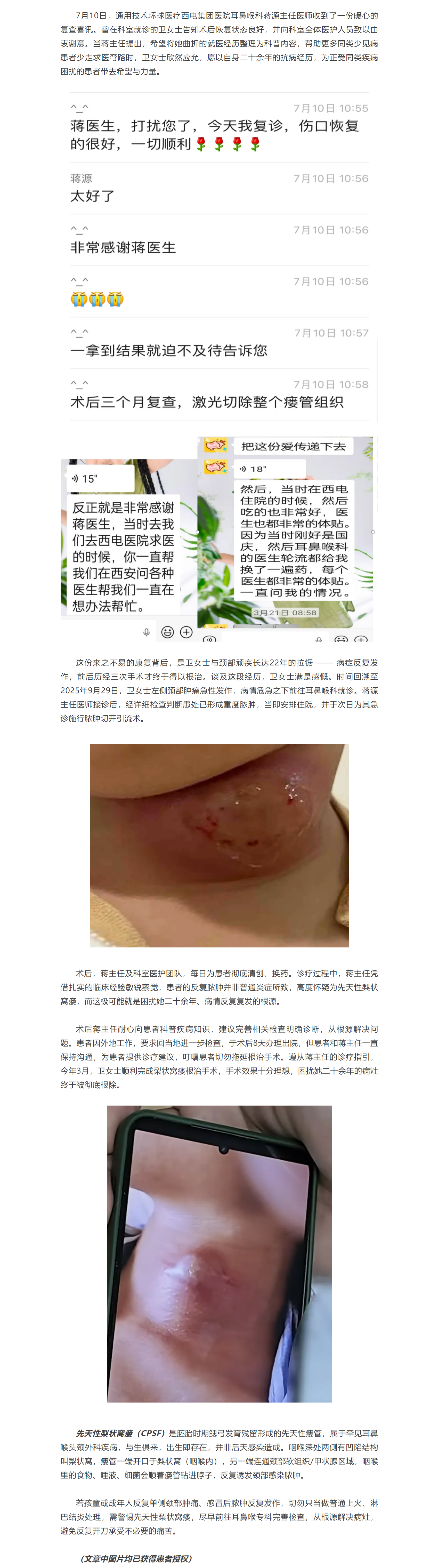 从反复脓肿到彻底根治！西电集团医院耳鼻喉科患者自愿分享罕见病就医历程，助力健康科普.png