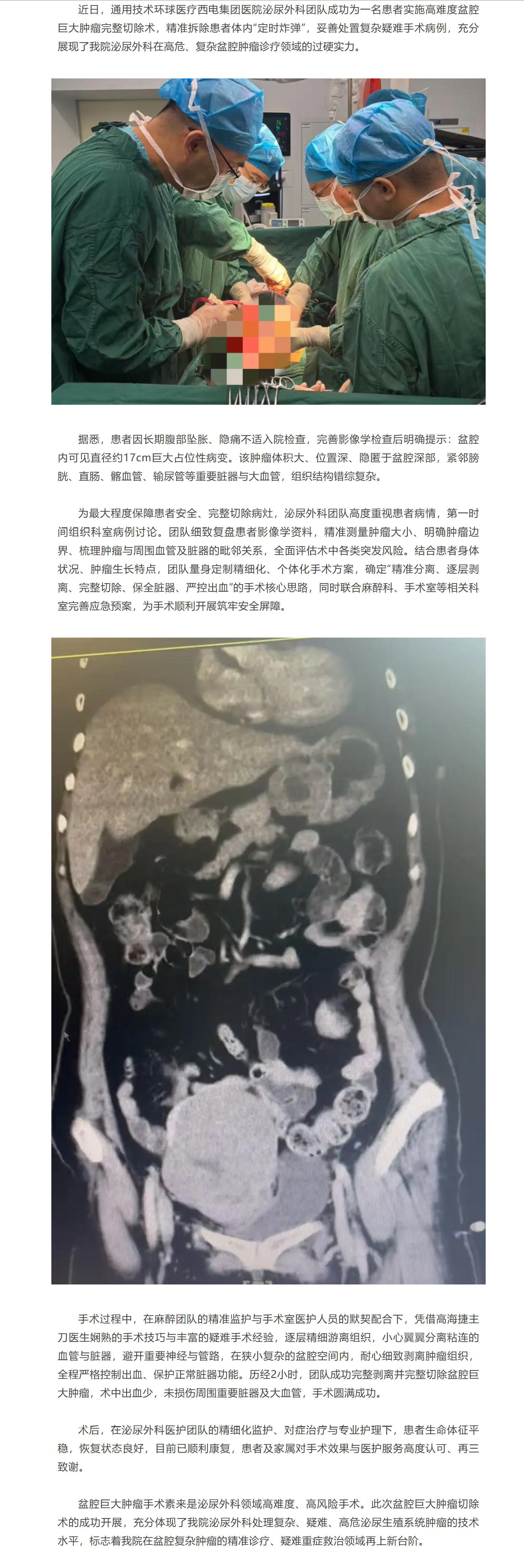 西电集团医院泌尿外科成功完成高难度盆腔巨大肿瘤切除术.jpg