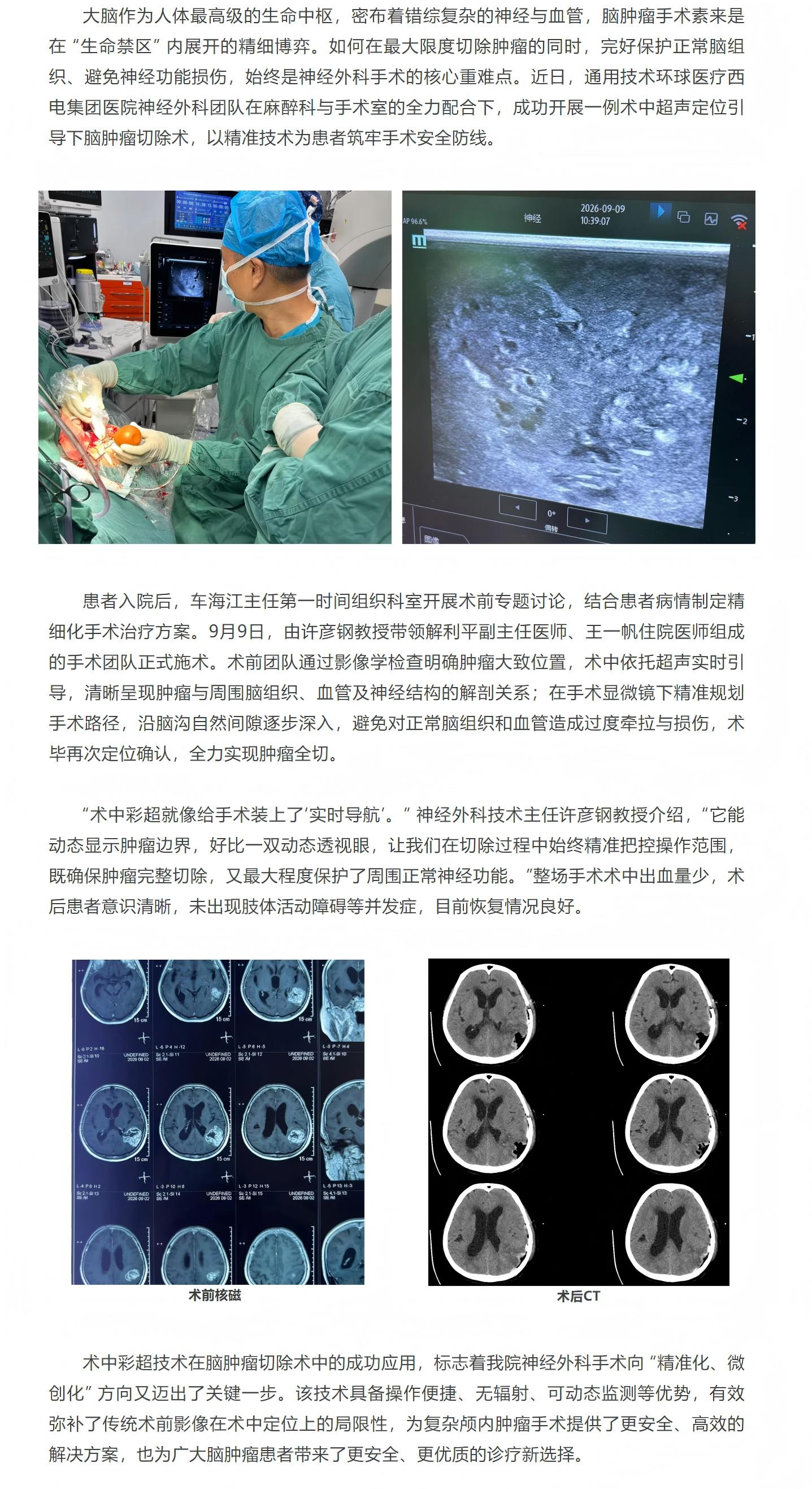 西电集团医院神经外科  成功开展一例术中超声定位引导下脑肿瘤切除术.jpg