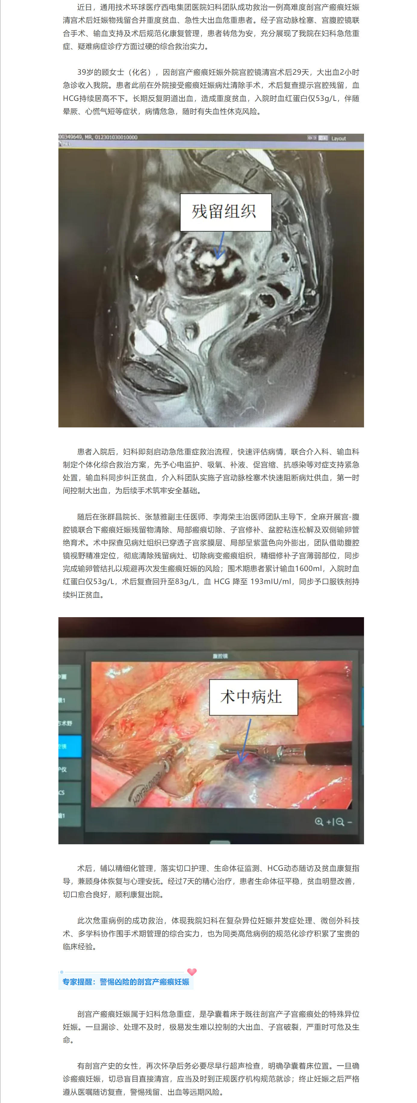西电集团医院多学科协作攻克剖宫产瘢痕妊娠难题，守护女性健康.jpg